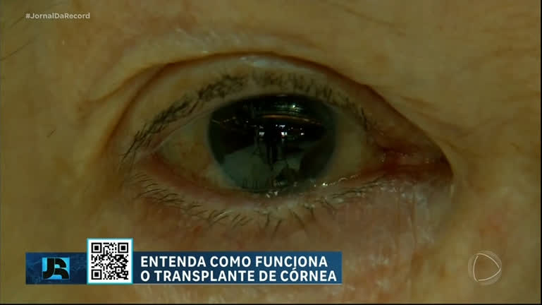 Vídeo: Mais de 27 mil pessoas esperam por transplante de córnea no país