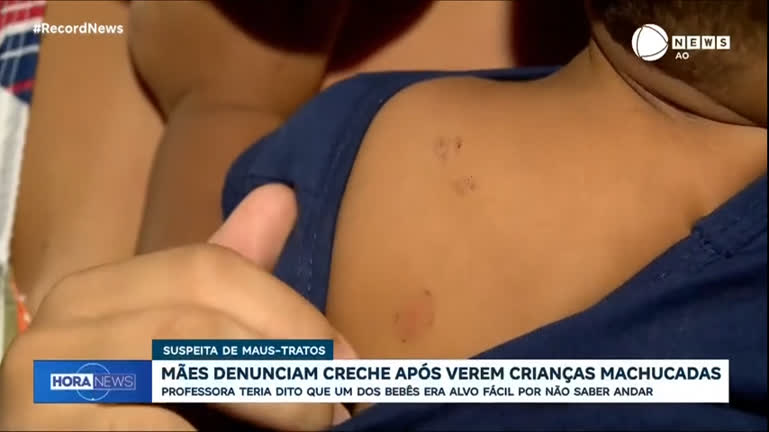 Vídeo: Mães denunciam creche após crianças voltarem para casa machucadas, no Rio