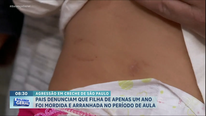 Vídeo: Pais denunciam que bebê voltou machucada de creche em São Paulo