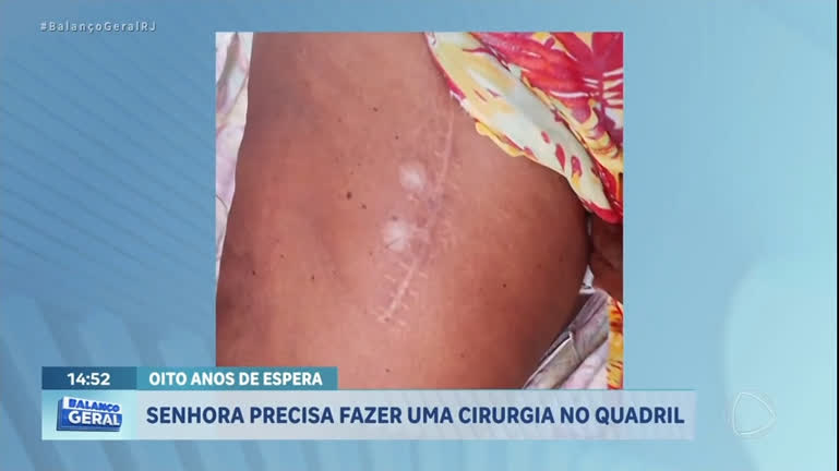 Vídeo: Idosa aguarda há oito anos por cirurgia no quadril no Rio