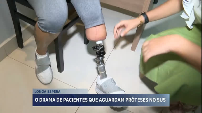 Vídeo: Pacientes esperam há quase um ano por implantação de próteses pelo SUS em MG