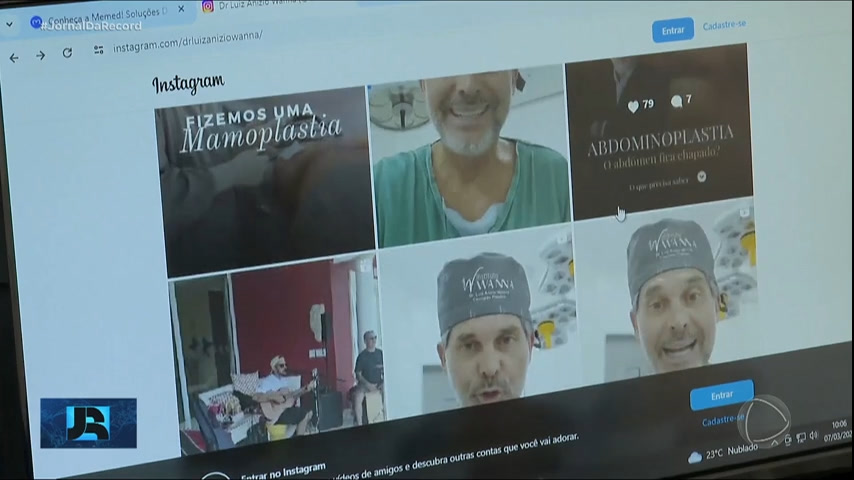 Vídeo: Conselho Federal de Medicina autoriza a divulgação de fotos de ‘antes e depois’ de procedimentos