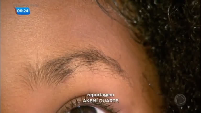 Vídeo: Criança de seis anos tem sobrancelha cortada por duas colegas na escola