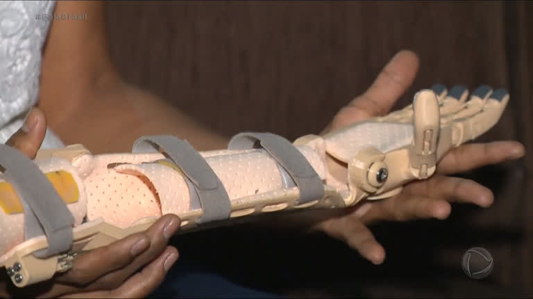 Vídeo: Menina de 7 anos ganha prótese feita por impressora 3D em Manaus
