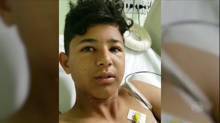 Vídeo: Vítima de linha chilena, garoto que sonhava com o futebol tem a perna amputada