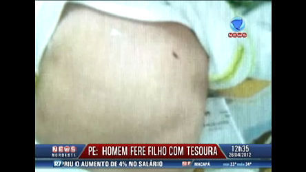 Vídeo: Homem fura o filho de 26 dias com tesoura em Pernambuco