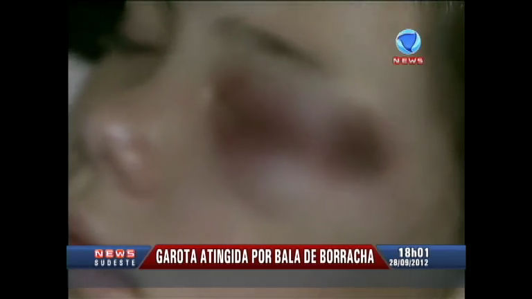 Vídeo: Garota pode ficar cega após ser atingida por bala de borracha disparada por policial