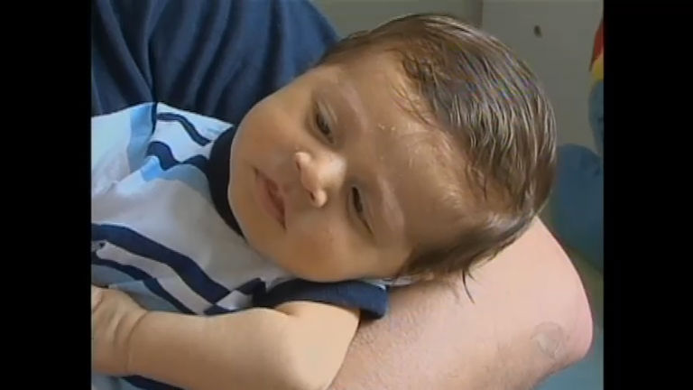 Vídeo: Bebê de um mês precisa de transplante de medula para sobreviver