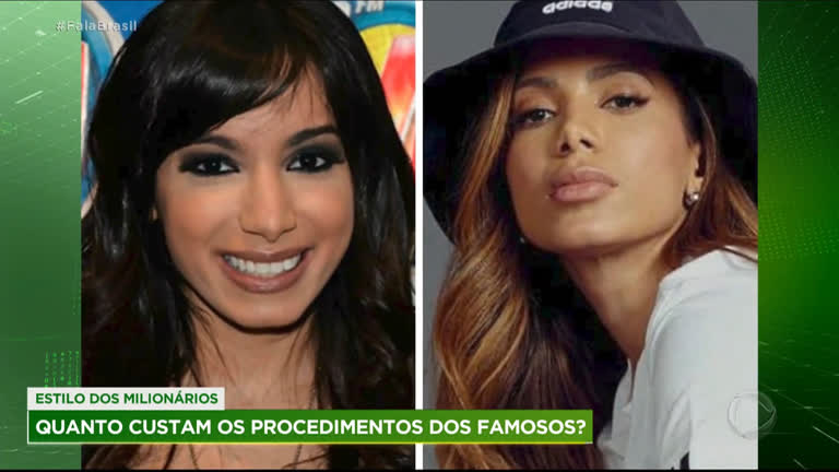 Vídeo: Gustavo Sarti revela quanto custam os procedimentos estéticos dos famosos