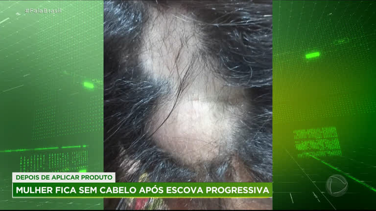 Vídeo: Escova progressiva causa queda de cabelo em mulher de Minas Gerais
