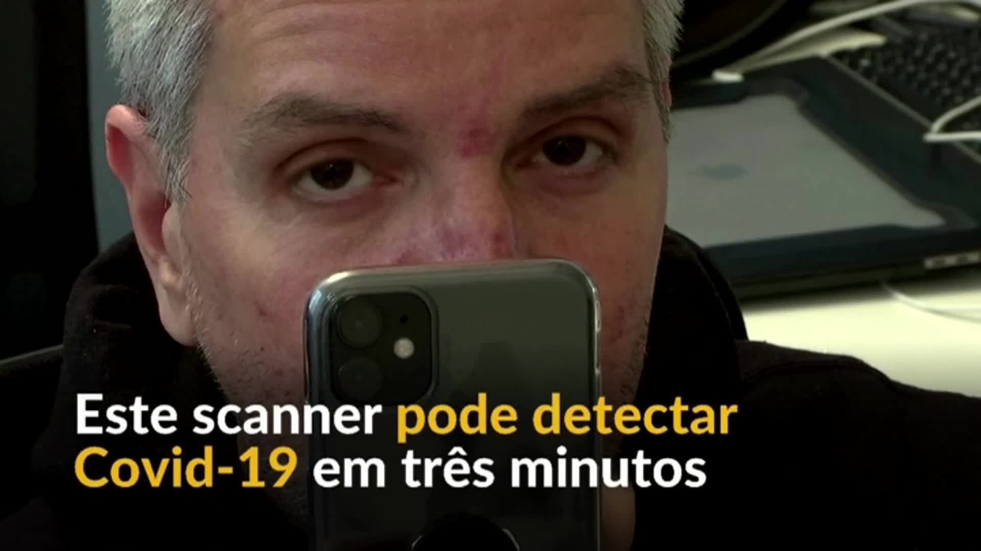Vídeo: O app que pode detectar a covid-19 ao escanear o olho