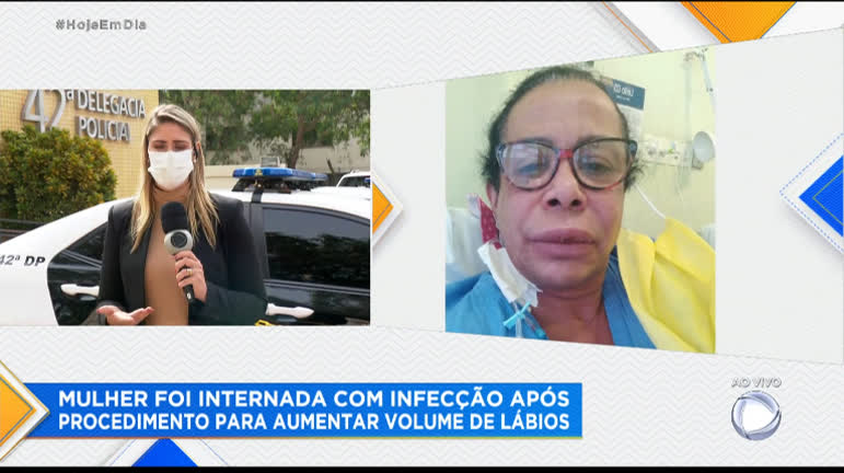 Vídeo: Mulher vai parar no hospital após fazer aplicação nos lábios