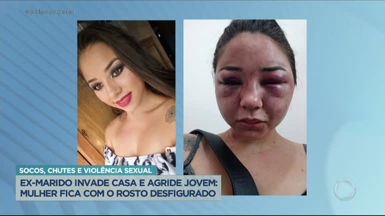 Vídeo: Jovem fica com rosto desfigurado após ser agredida pelo ex-marido