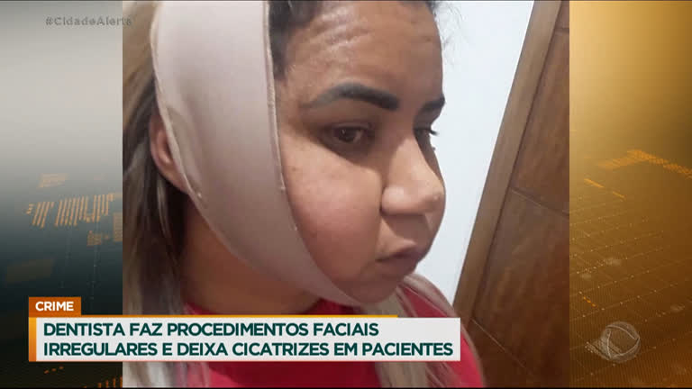 Vídeo: Dentista faz procedimentos faciais irregulares e deixa cicatrizes em pacientes