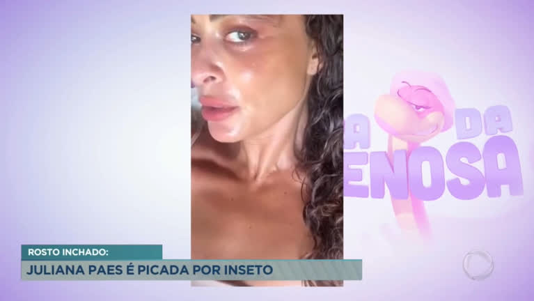 Vídeo: Juliana Paes fica com rosto inchado após ser picada por inseto