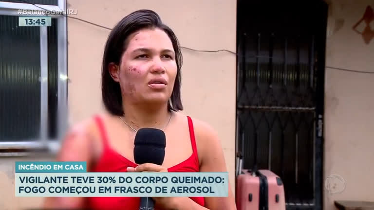 Vídeo: Mulher tem parte do corpo queimado após explosão de aerossol