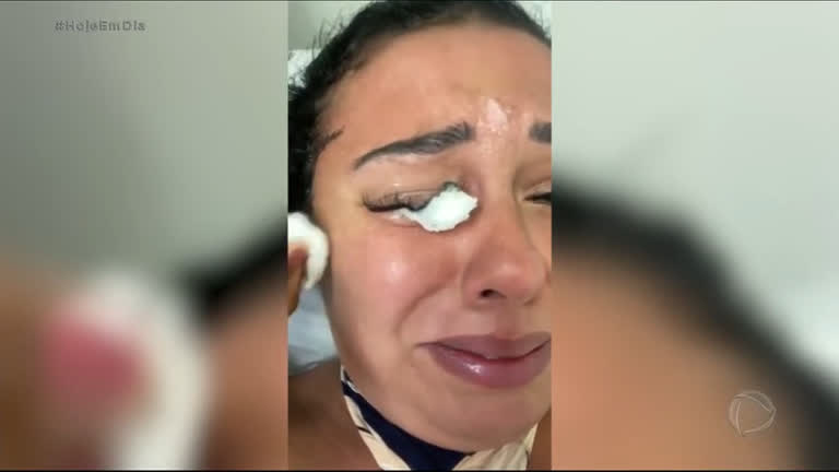 Vídeo: Empresária quase fica cega em procedimento para extensão de cílios