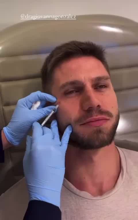 Vídeo: Jonas Sulzbach aplica botox após conselhos de Mari Gonzalez