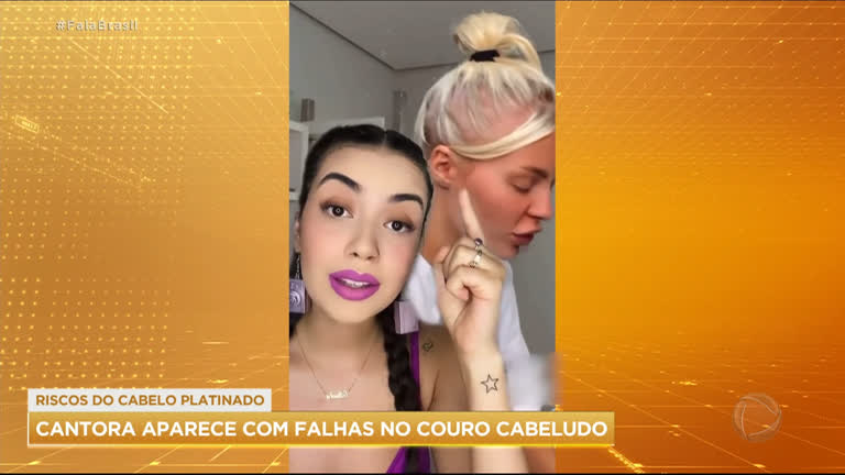 Vídeo: Luísa Sonza chama atenção ao aparecer com falhas no couro cabeludo